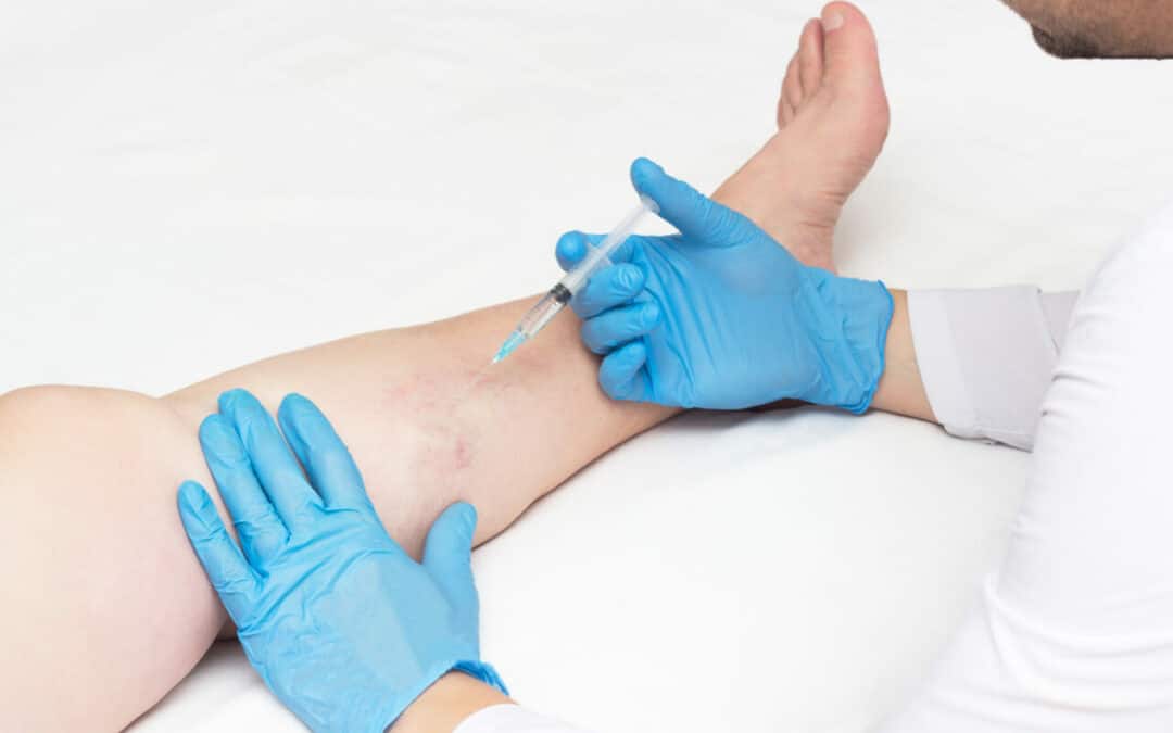 Do veins grow back after removal?