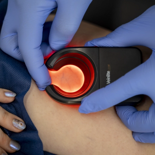 Dr_Byron_veinlite_optimized_optimized Dr. Shaun Cole performing a leg ultrasound evaluation on a patient at Vein Centers NY in Astoria, New York.